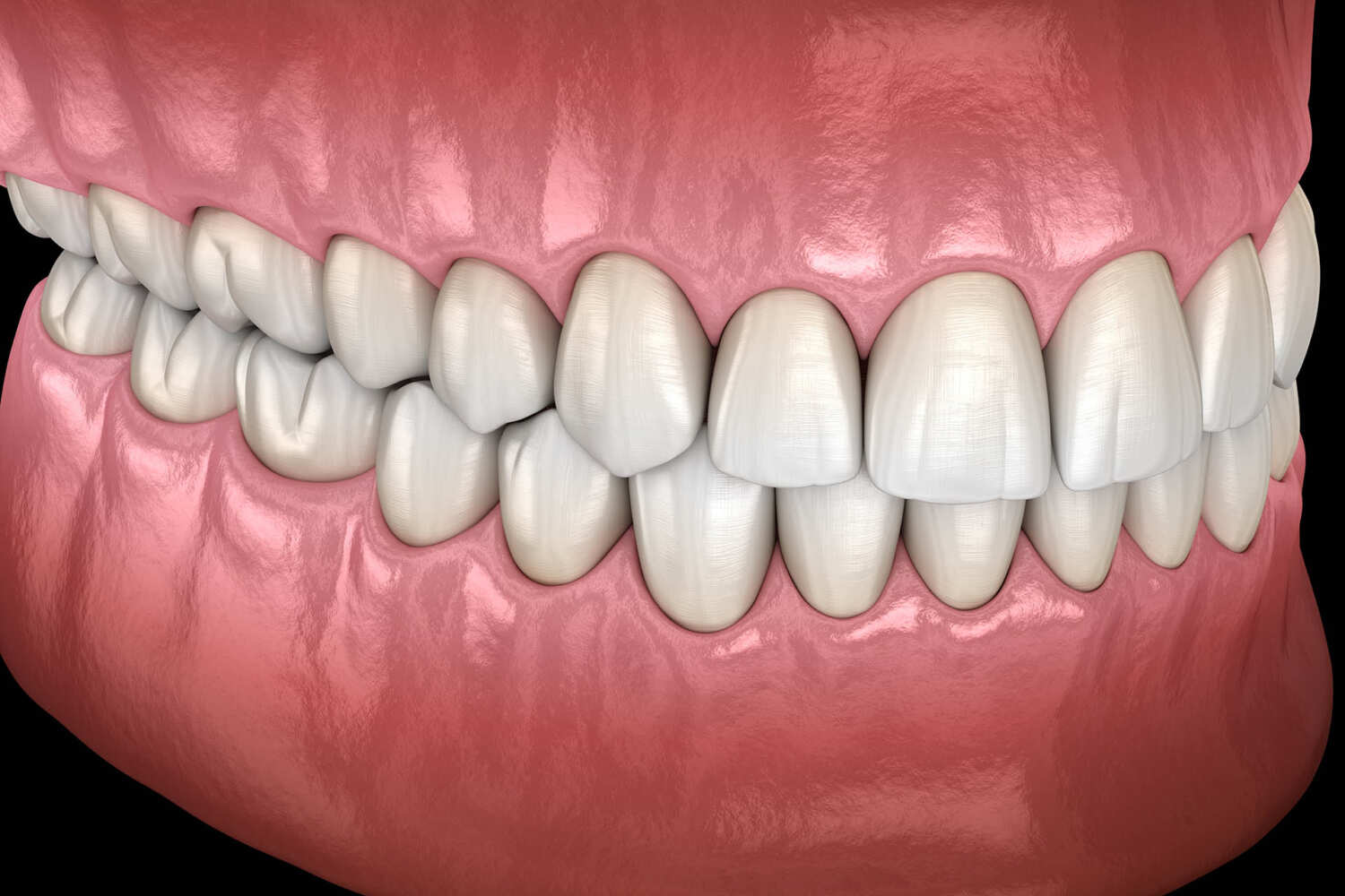 You are currently viewing AVEZ-VOUS UNE OCCLUSION EQUILIBREE ?